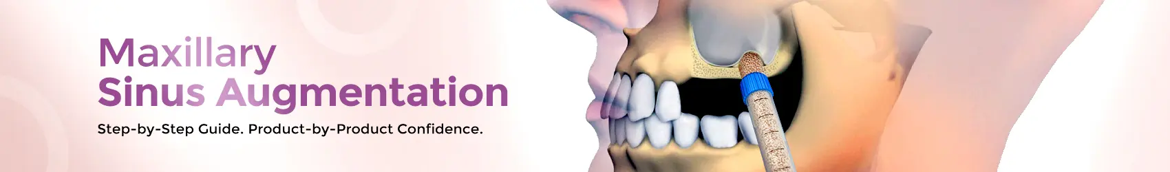 1747806730798-HomePageMaxillaryDT (1)