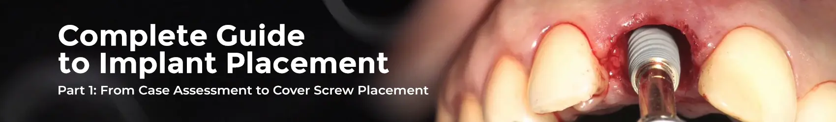 1748083538614-HomePageFissureSealantDT(1)