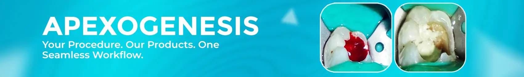 1748514611067-homeapexogensisdt-1