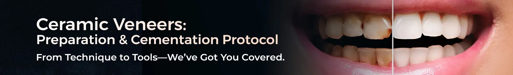 1748955698986-HomePageCermaicveneerstDT