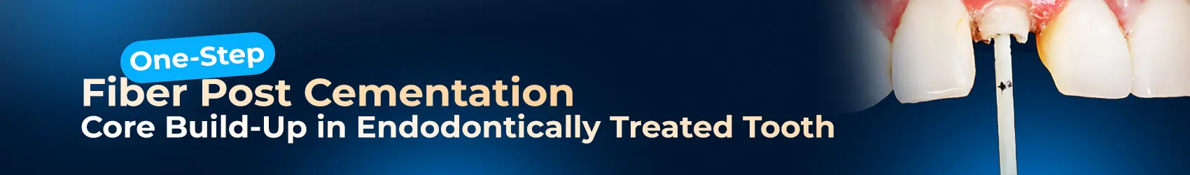 1749644421140-HomePageFiverpostDT