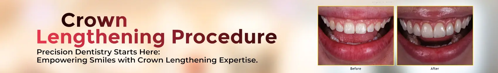 1752498961882-HomePageCrownDT