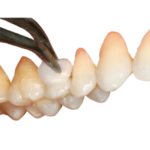 GC Fuji Varnish (5gm) - Image 4