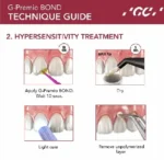 GC G-Premio Bond - Image 7