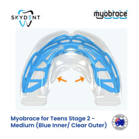 Teens Stage 2 (T2)
