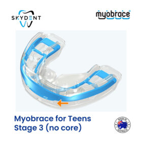 Myobrace for Teens  Stage 3