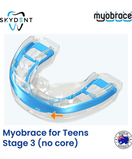 Myobrace for Teens  Stage 3